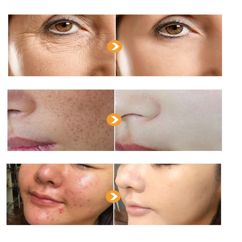 Moisturizing Anti-wrinkle Face Cream Repair Skin Barrier Nourishing Whitening Cream Shrink Pores Fades Fine Lines Firm Skin Care