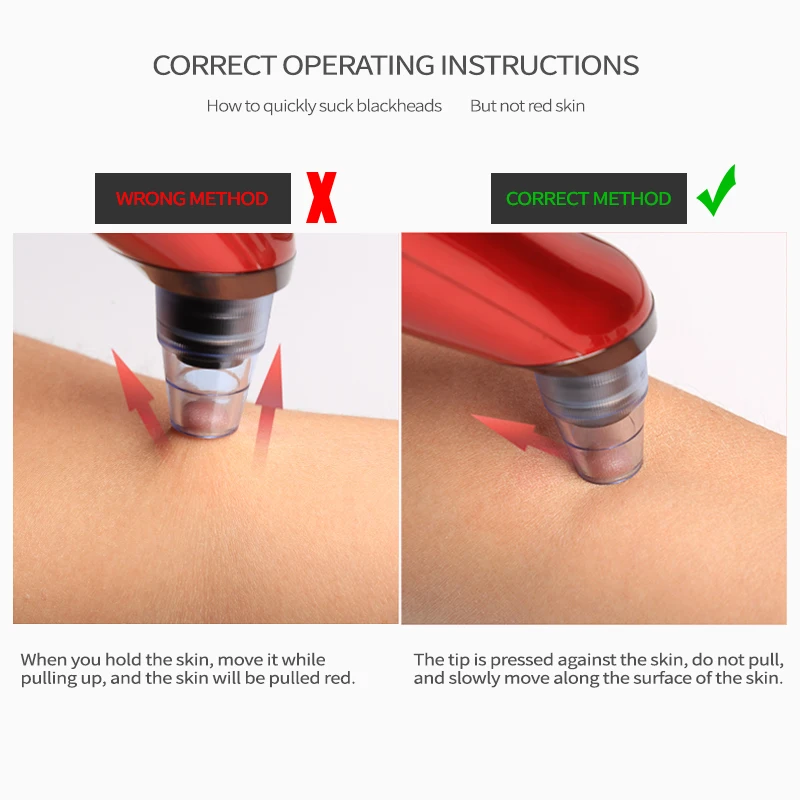 Вакуумный очис Для удаления черных точек уход за кожей устраняющий недостатки инструмент черные точки на носу идиома Pimpl съемные фото уход за кожей лица поры, акне, прыщей вакуумный лица поглощает акне пор точка Нуар