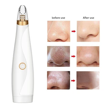 

Blackhead Remover acuum Electric Nose Face Deep Cleansing Skin Care Machine Blackhead Remover Black Spots Pore Cleaner