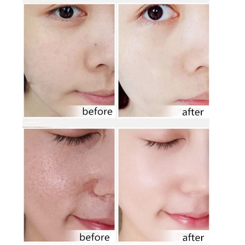 Dr Sugarm 2Pcs Hyaluronic Acid Serum Face Care Moisturizing Anti Aging Anti Wrinkle 1 Acne Repair 4