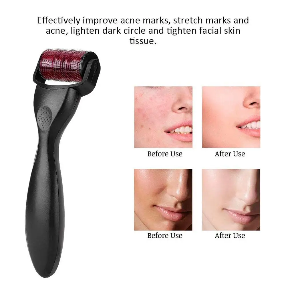 3 in 1 DermaRoller Titanium Micro needle Roller for Face Body Massager & Hair Loss Treatment Face Roller Massager 3 in 1 DermaRoller Titanium Micro needle Roller for Face Body Massager & Hair Loss Treatment Face Roller Massager