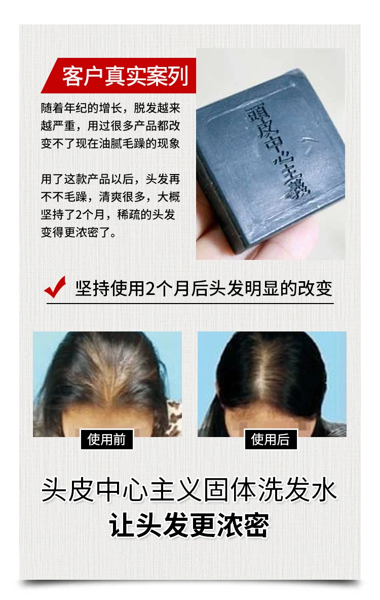 2pcs x 30g Japan black soap solid shampoo,Oil control Anti-dandruff, anti-itching and anti-alopecia without silicone oil