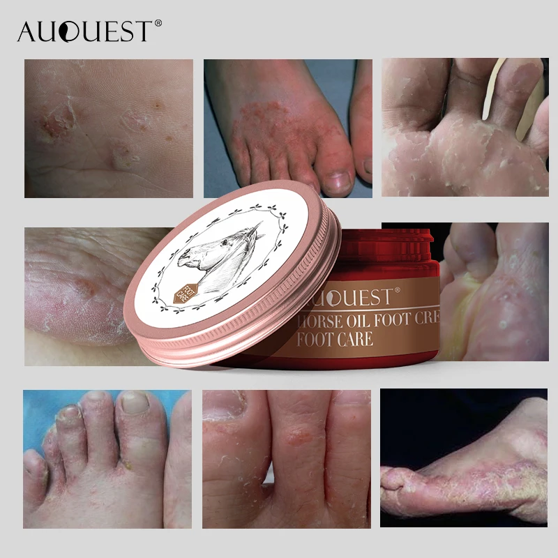 AuQuest Antifungal Foot Cream for Itching Peeling Rough& Face Serum for Moistirizing Skin Whitening Soft Smooth Skin Care