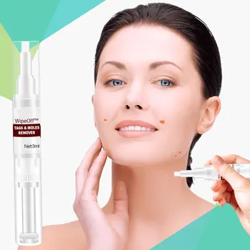 

Hot Wipe Off Tags Moles Remover 3ml Skin Tags Mole Remover Effective Formula for Skin Tags Anti Moles Verruca Remedy Removal t6