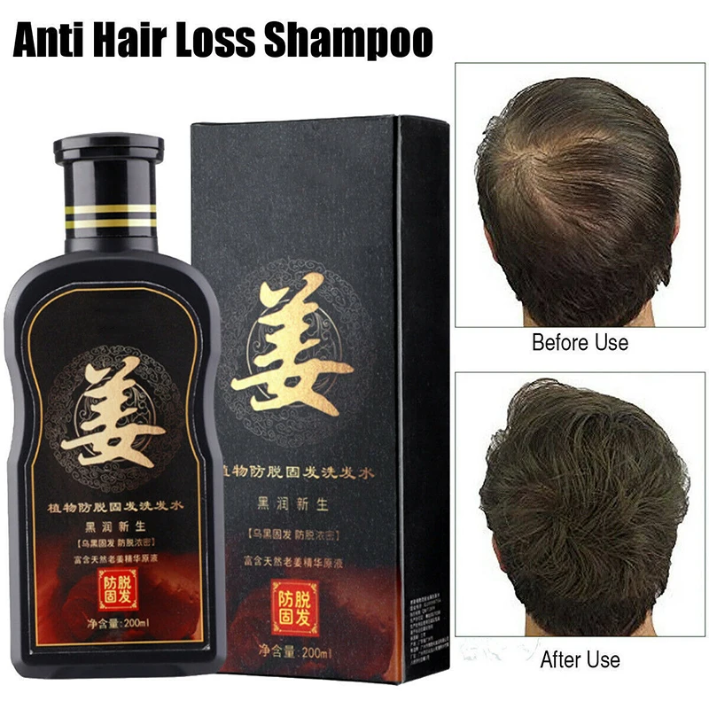 200ml Natural Ginger Shampoo Oil-Control Anti Dandruff Itching Anti-Loss Scalp Treatment Grow Thick Hair Growth Products 200ml Natural Ginger Shampoo Oil-Control Anti Dandruff Itching Anti-Loss Scalp Treatment Grow Thick Hair Growth Products
