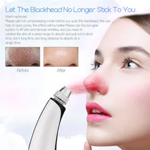 Для чистки лица электрический прибор для вакуумной чистки лица всасывания лицо поры чистящее средство для ухода за кожей, против акне, прыщей, аппарат для лифтинга