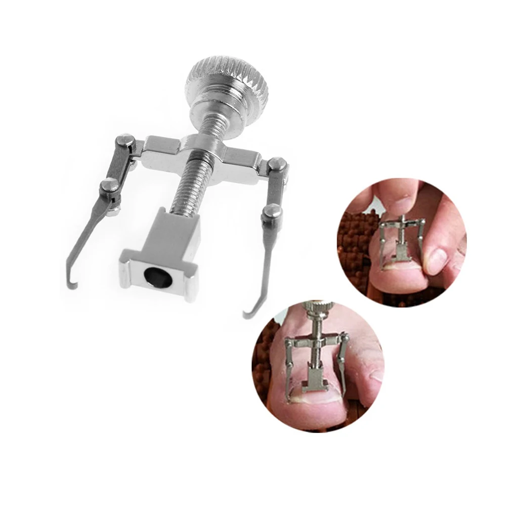 

Ingrown Toe Nail Recover Correction Fixer Pedicure Tool Foot Nail Orthotic Lever Mechanics To Change The Angle Of Nail Growth