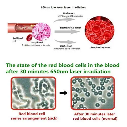 Excellent Tinnitus Ear Laser Therapy Watch Laser Acupuncture Machine Tinnitus/ Otitis/ear hearing problem 4