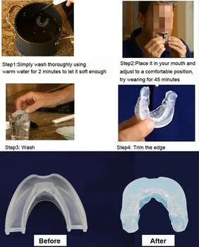 

Stop Snoring Anti Snore Soft Silicone Mouthpiece Apnea Guard Bruxism Tray Night Sleeping Aid P9