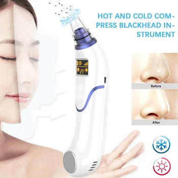 

Hot and cold compress blackhead removal instrument for removing blackheads and acne facial electric acne removal blackhead tool