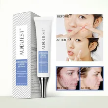 Крем от акне, увлажняющее масло Управление уменьшение пор, акне точек крем для удаления шрамов восстанавливающий крем с YUF99