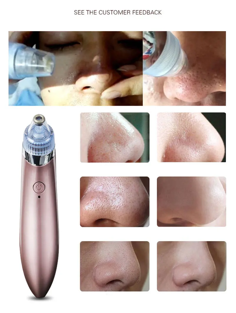 Электрическая щетка для чистки лица машина Blackhead вакуумное Удаление прыщей пилинг для пор подтяжка лица омолаживающий массажер инструменты