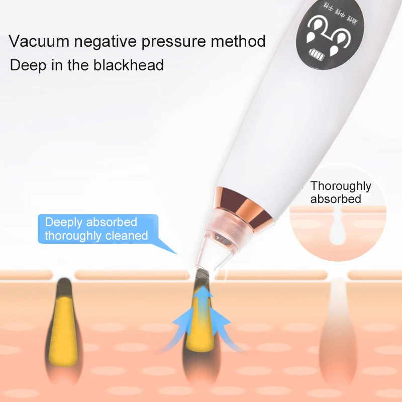 Вакуумный очиститель пор для чистки лица Черное очищающее средство от черных точек прыщи акне удаление угрей средство для устранения черных точек инструмент для удаления прыщей акне