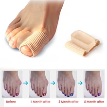 Приспособление для устранения деформации пальца на ноге Bunion корректор ортопедический для ног Коррекция педикюра коррекция педикюра