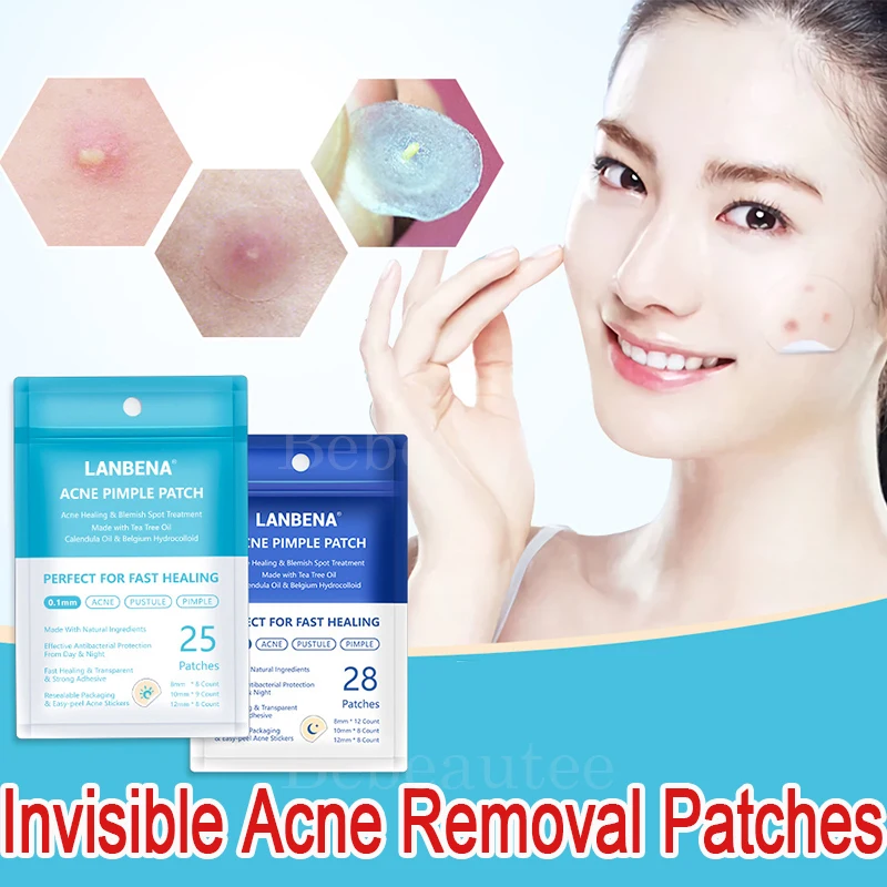 

LANBENA Invisible Acne Removal Patches LAMBENA Strips From Freckles of Nose Face Against-acne Pimple LABENA Anti Spots Extrusion