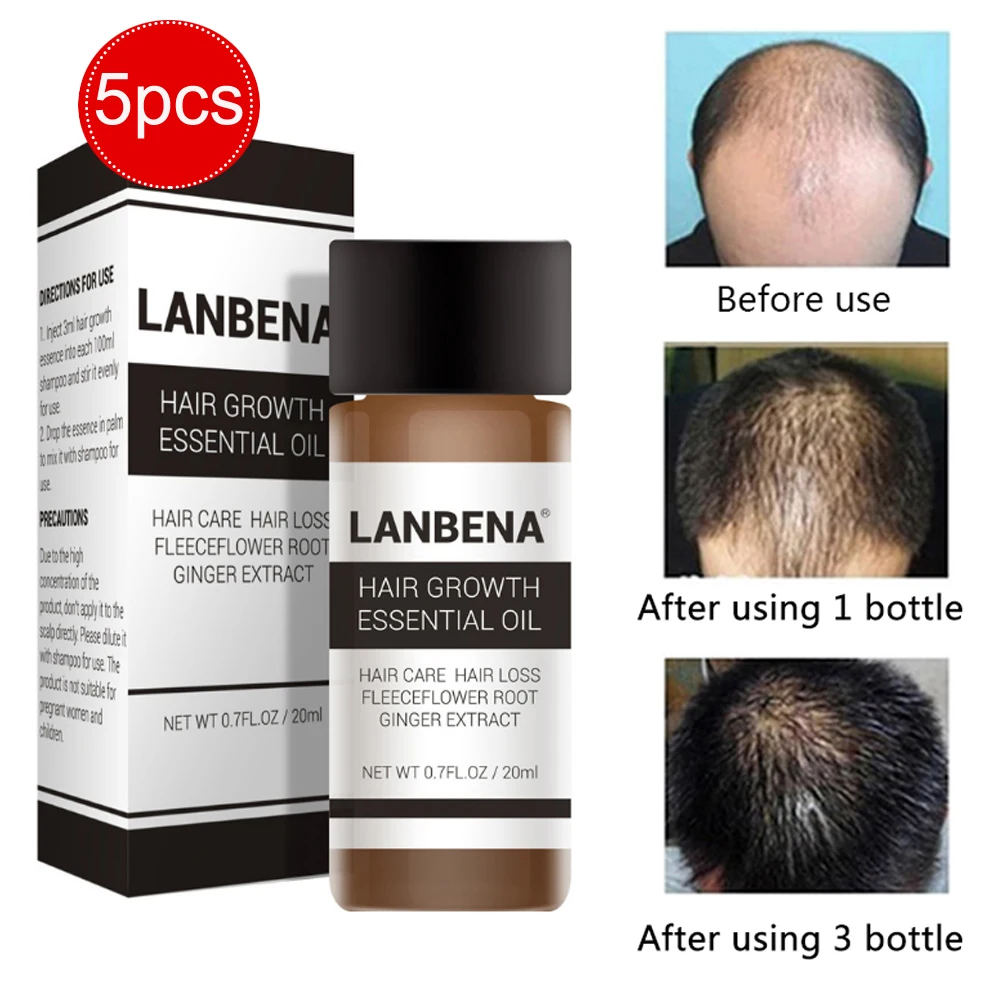 LANBENA 20 мл эссенция для роста волос Быстрый мощный Уход за волосами Эфирное Масло жидкое лечение Предотвращение выпадения волос для мужчин и женщин
