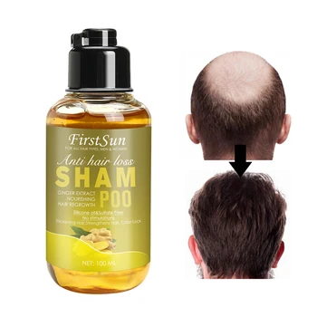 

100ml Natural Plants Hair Shampoo Anti Hair Loss Natural Ginger Hair Care Shampoo Hair Loss Treatment Hair Thickening Shiny Hair