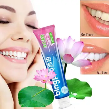 

100/180g Intensive Stain Removal Whitening Toothpaste Viaty Baking Soda Mint Flavor Toothpaste Prevent Tooth Decay Tooth Care