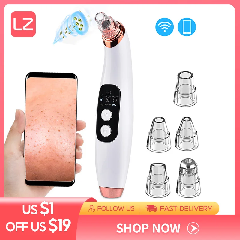 Средство для удаления угрей Visual Blackhead Pore Acne Vacuum Removal с помощью камеры Инструмент