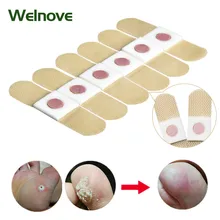 24pcs Foot Corn Killer Pads Removal Calluses Plantar Warts Thorn Plasters Medical Sticker Relieving Pain Patch Health Care D2399