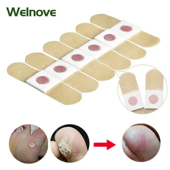 

24pcs Foot Corn Killer Pads Removal Calluses Plantar Warts Thorn Plasters Medical Sticker Relieving Pain Patch Health Care D2399