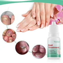 Средство для восстановления ногтей, жидкое средство для удаления грибка, защитное средство для ногтей, питательное, осветляющее, для рук, для ухода за ногами, травы, против инфекции