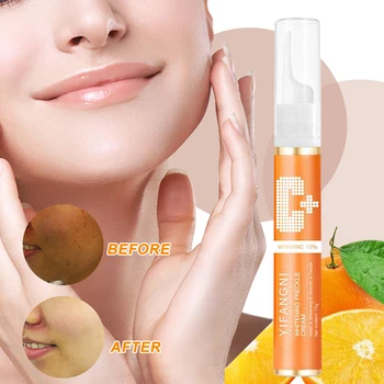

VC Freckle Remover Cream Skin Whitening Gel Antibacterial Reduce Pigmentation
