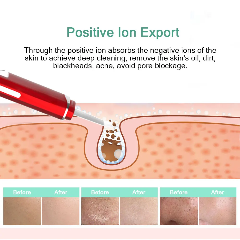 ANLAN Ultrasonic Skin Scrubber Face Deep Cleaning Machine Remove Blackhead Pore Acne Reduce Wrinkles Facial Lifting Clean Tools