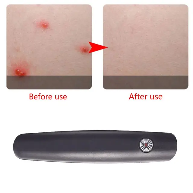 Summer Useful Outdoor Travel Bites Relieve Anti-Itch Pen Mosquito Insect Irritation Itching Reliever Helper for Children Adults 5