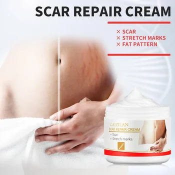 

Precious Skin Care Body Cream Stretch Marks Repair Cream Removal Scar Marks Pregnancy Cream Fat Scar Striae Treatment TSLM2