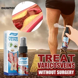 Varicose Veins treatment essential oil Relief Phlebitis Angiitis Remedy Pain Spray for Spider Veins Edema Nerve Pain Leg Pain