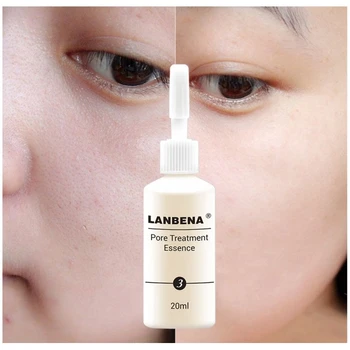 

LANBENA Essence Nose Blackhead Remover Acne Treatment Shrink Pores Skin Firming