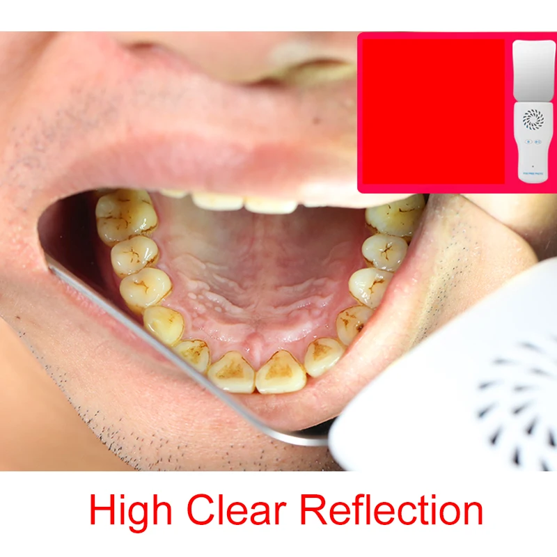 Espejos antiniebla automáticos dentales para fotografía Oral, reflectores de vidrio, espejos de ortodoncia para bucal oclusal Lingual