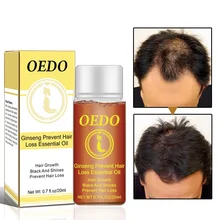 

OEDO 0.7 Fl Oz/20ml Ginseng Prevent Hair Loss Product Hair Growth Essential Oil for Repairing Damaged Hair Care Treatments TSLM1