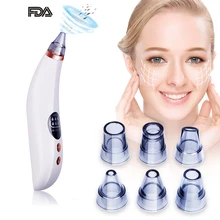 USB средство для удаления черных точек для лица вакуумный Уход за Кожей акне очиститель пор Удаление прыщей вакуумные всасывающие инструменты для ухода за лицом puntos negros