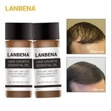 LANBENA 2 шт. Уход за волосами масло для роста волос экстракт имбиря лечение выпадения волос Восстановление густых волос продукты сыворотка быстрый рост волос
