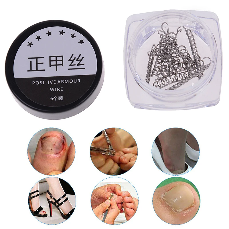 

12Pcs/Set Waterproof Recover Toenails Corrector Ingrown Toe Nail Correction Wire Fixer Pedicure Paronychia Foot Care Tool