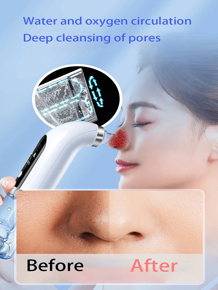Blackhead Remover Nose Face Deep Cleaner Pore Acne Pimple Removal Vacuum Suction Facial Beauty Clean Skin Tool Dropshipping
