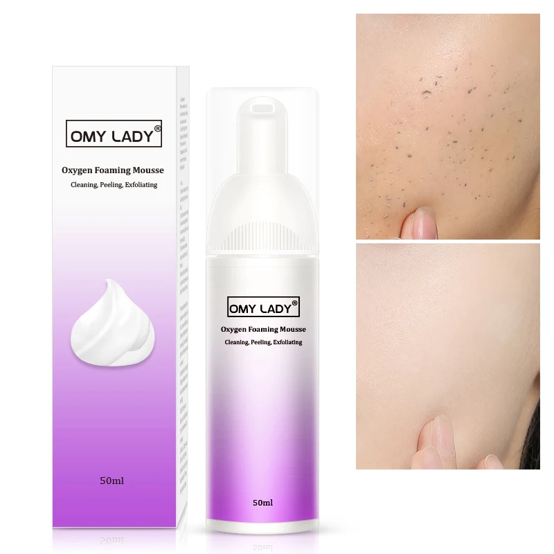 

Moisturizing Oil Control Shrink Pores Remove Blackhead Face Cleanser,Oxygen Foaming Mousse Deep Cleansing Face Cleanser