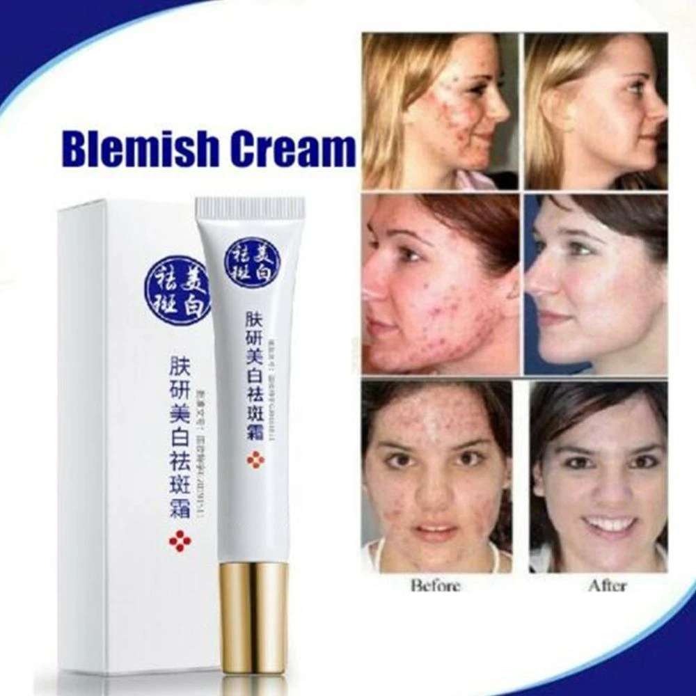 scar cream for dark spots