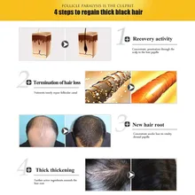 30 мл увлажняющий восстановления поврежденных волос средство для роста волос Для мужчин Для женщин сухой выпадения волос питающее масло отрастания волос жидкий экстракт