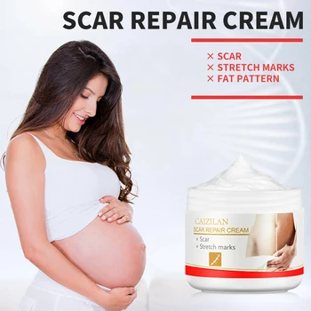 

Remove Pregnancy Scars Acne Cream Stretch Marks Treatment Maternity Repair Anti-Aging Anti-Winkles Firming Body Creams Skin Care