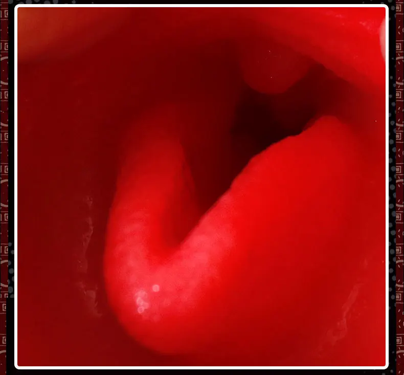 9171015555_1387434852