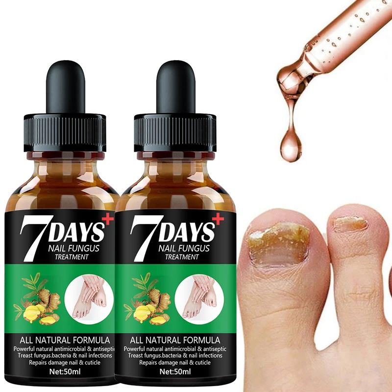 Nail Fungus Treatment Essence Serum Care Hand and Foot Care Removal Repair Gel Anti-infective Paronychia Onychomycosis