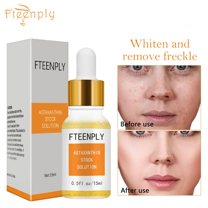 Astaxanthin Stock Сыворотка для лица с гиалуроновой кислотой FTEENPLY, увлажняющая, отбеливающая, против старения, от морщин, восстанавливающая от солнечных ожогов, подтягивающая, укрепляющая, для ухода за кожей - Вес нетто: Astaxanthin Stock