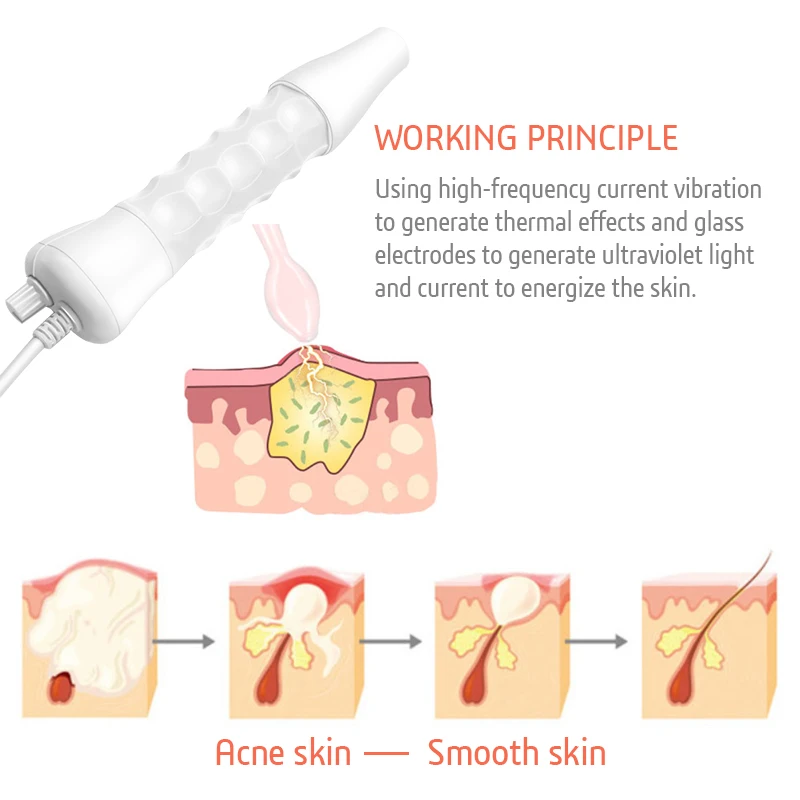 Высокочастотный электрод для лица, стеклянная трубка, палочка для ухода за кожей, средство для удаления акне, высокочастотная спа-машина для лица, средство для удаления морщин