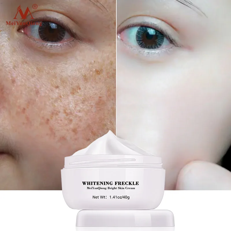 Powerful Whitening Freckle Cream Remove Acne Spots Melanin Dark Spots Face Lift Firming Face Skin Care Beauty Essentials-1