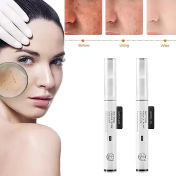 

Instant spot remover gel whitening Vitamin C Anti freckle cream pen effectively remove freckle pigmented Melanin spots