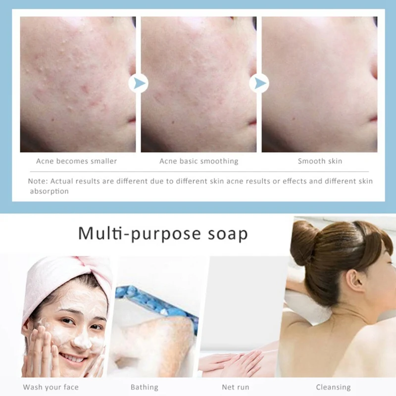 Niacinamide морская соль жемчужное мыло контроль масла анти-acnes анти-клещи увлажняющее Отбеливающее Мыло 100 г