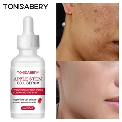Apple Stem Cell Anti-Aging Face Serum Remove Wrinkles Whitening Moisturizing Essence Fades Fine Lines Melanin Brighten Skin Care